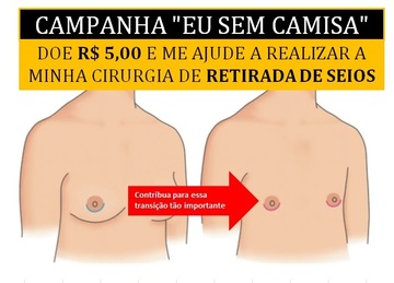 Thumb doe 5 reais
