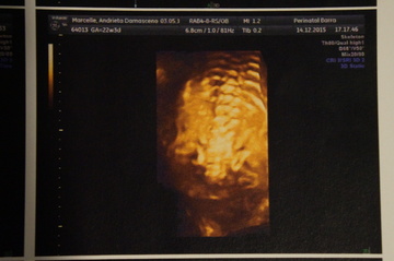 Thumb dsc02702